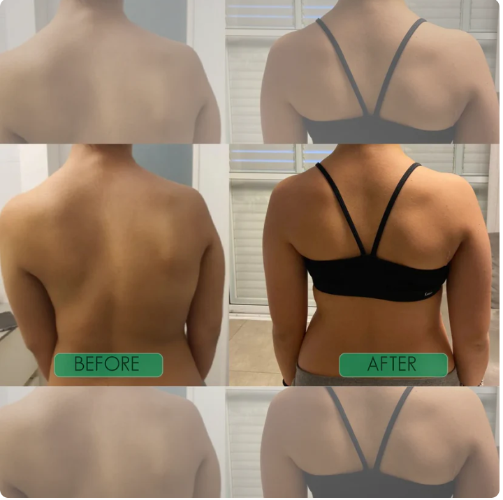 Evorola™ Instant Posture Corrector