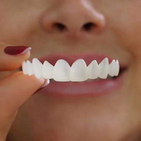Lonryd SmileFlex™ Veeners